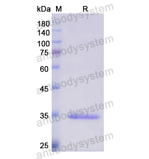Recombinant Human SCGN, N-His