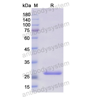 Recombinant Human STC2, N-His