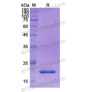 Recombinant Human PDE5A, N-His