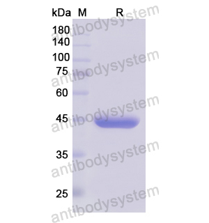 Recombinant Human DFFB, N-His