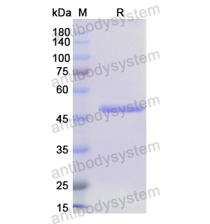 Recombinant Human ALDH1A2, N-His