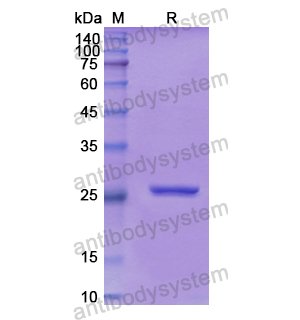 Recombinant Human SLIT2, N-His