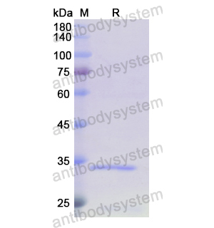 Recombinant Human TOMM70, N-His