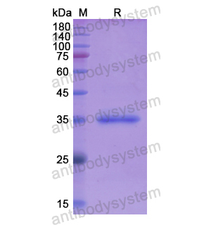 Recombinant Human ERLIN2, N-His