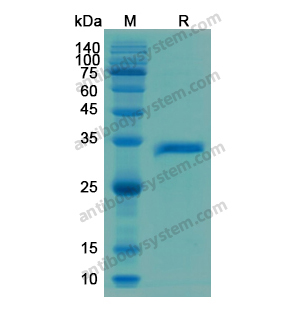 Recombinant Human DKK1, N-His