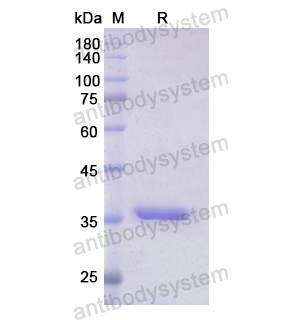 Recombinant Human GLS, N-His