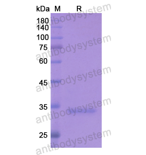 Recombinant Human ZWINT, N-His
