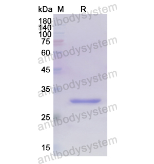 Recombinant Human LUC7L3, N-His