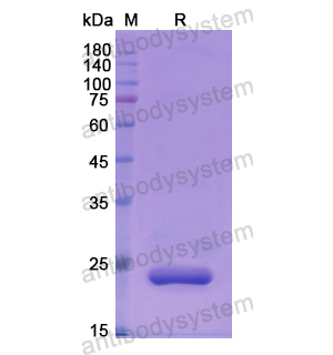 Recombinant Human LYPLA2, N-His