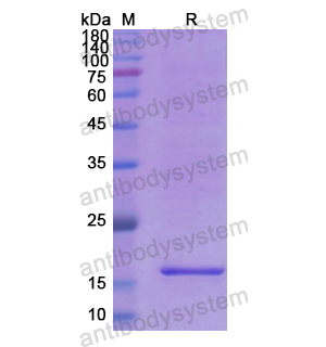 Recombinant Human SVIL, N-His