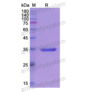 Recombinant Human PARN, N-GST