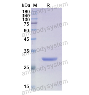 Recombinant Human SGPL1, N-His