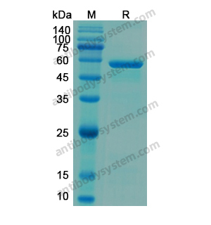 Recombinant Human H6PD, N-His