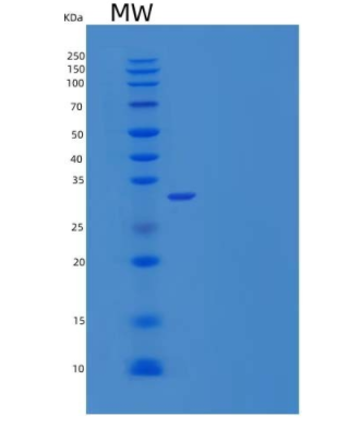 Recombinant Human Corticotropin-Releasing Factor-Binding Protein/CRHBP Protein(C-6His)