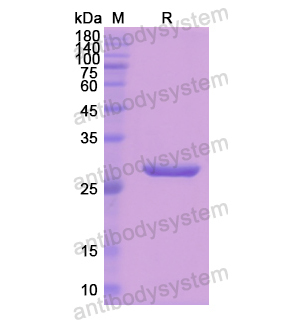 Recombinant Human ANGPTL1, N-His