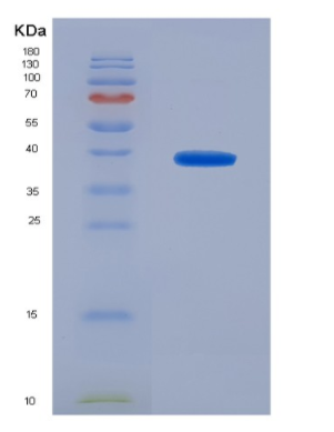 Eukaryotic Triggering Receptor Expressed On Myeloid Cells 1 (TREM1)