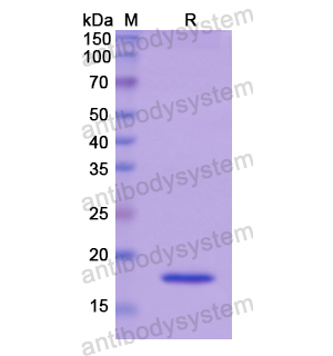 Recombinant Human FADS2, N-His