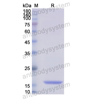 Recombinant Human DDAH2, N-His