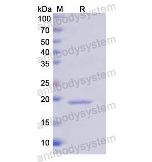 Recombinant Human IL18BP, N-His