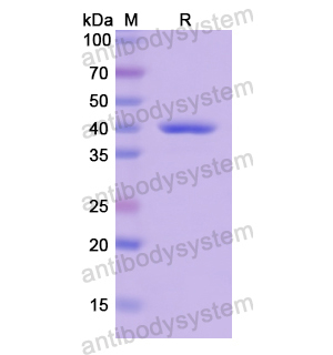 Recombinant Human LDHA, N-His