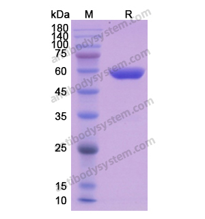 Recombinant Human ALDH1A1, N-His