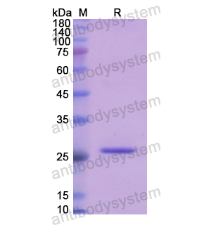Recombinant Human GLUD1, N-His