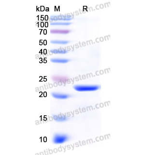 Recombinant Human DHFR, N-His