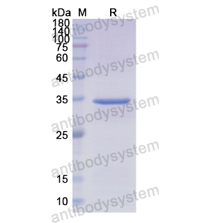 Recombinant Human CP, N-His