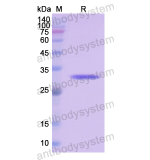 Recombinant Human OTC, N-His