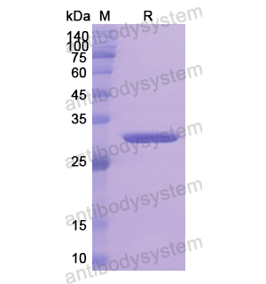 Recombinant Human HP, N-His