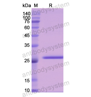Recombinant Human F9, N-His