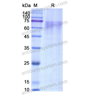 Recombinant Human F9/Factor IX, C-His
