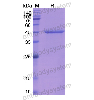 Recombinant Human a1AT/Serpin A1/SERPINA1, N-His