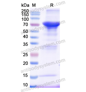 Recombinant Human AGT, N-GST