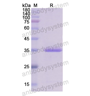 Recombinant Human C5, N-GST