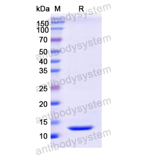 Recombinant Human CSTA, N-His