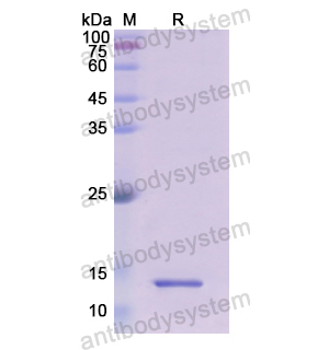 Recombinant Human HRAS, N-His