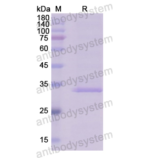 Recombinant Human TGFA/TGF-alpha, N-GST