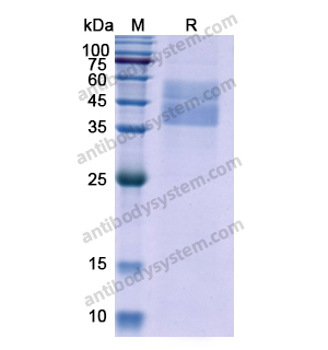 Recombinant Human TGFB1/TGF-beta-1, C-His