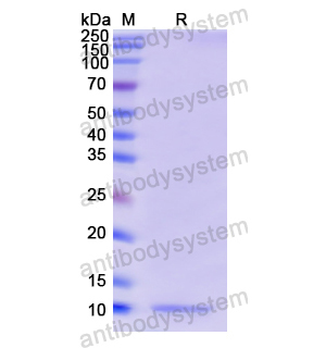Recombinant Human GNRH1, N-His