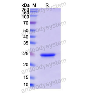 Recombinant Human PRL, N-His