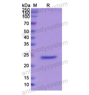 Recombinant Human GH2, N-His