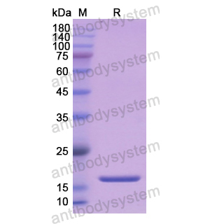 Recombinant Human VIP, N-His