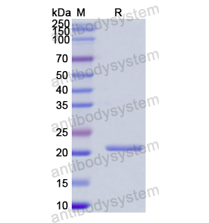 Recombinant Human IFNA2/IFN-alpha-2, N-His