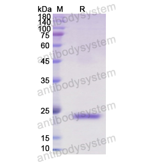Recombinant Human IFNB1/IFN-beta, N-His