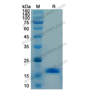 Recombinant Human IFNG/IFN-gamma, N-His