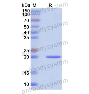 Recombinant Human EPO, N-His