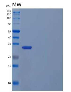 Recombinant Human Inositol Monophosphatase 1/IMPA1/IIMPase 2 Protein(N-6His)