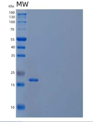 Recombinant Human Peptidyl-Prolyl Cis-Trans Isomerase H/PPIH Protein(N-6His)