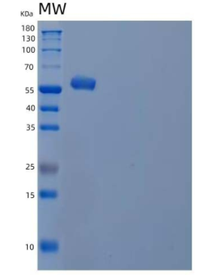 Recombinant Human Interferon Regulatory Factor 5/IRF5 Protein(C-6His)